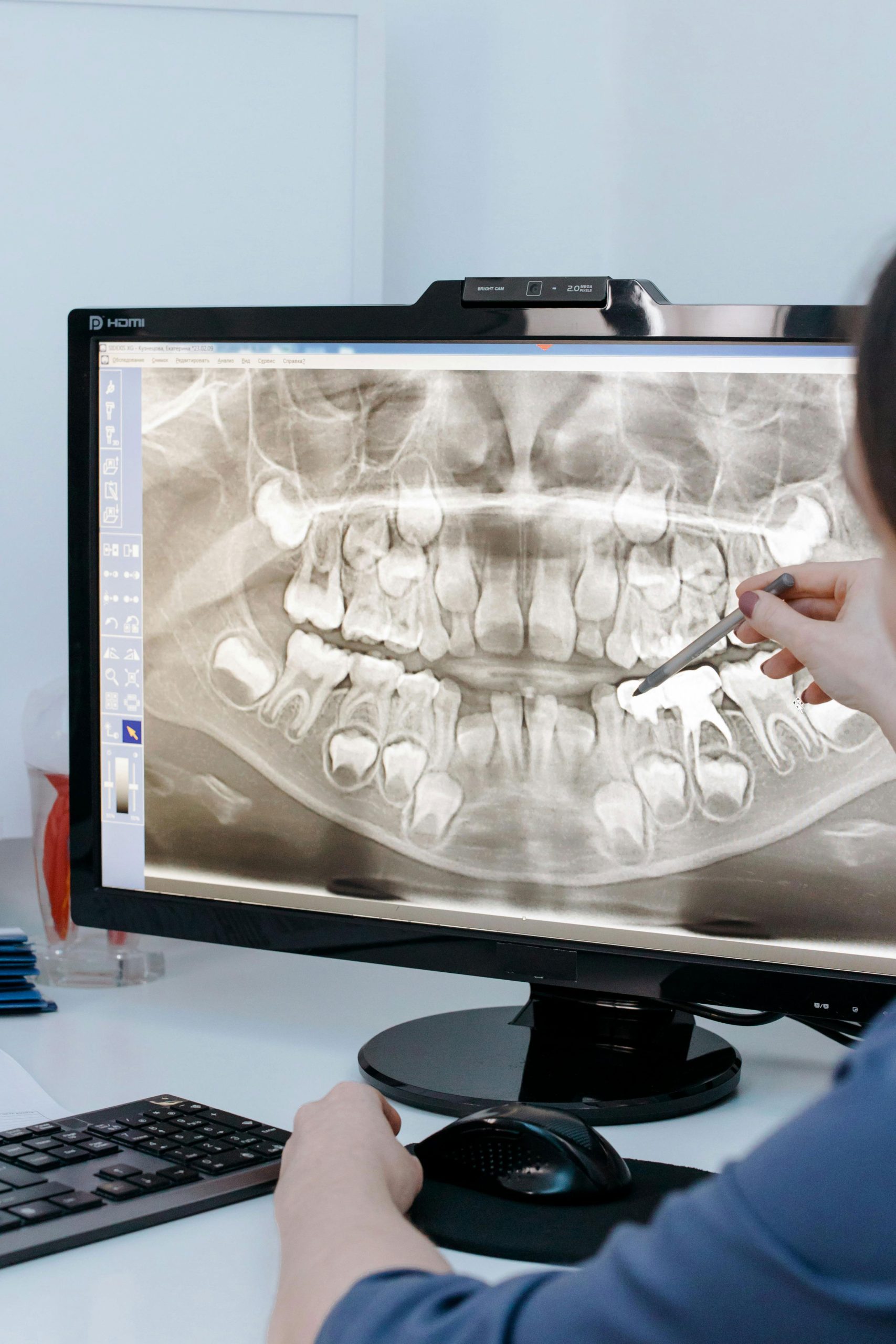 dental crowns in Menomonee Falls dental crowns in Menomonee Falls, Menomonee Falls dental crowns, dentals crown dentist in Menomonee Falls
